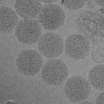 Fig 1.Unstained Rift Valley fever virus (RVFV) particles embedded in vitreous ice, and imaged with an field emission gun electron microscope